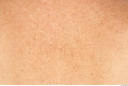 Photo Textures of Human Skin